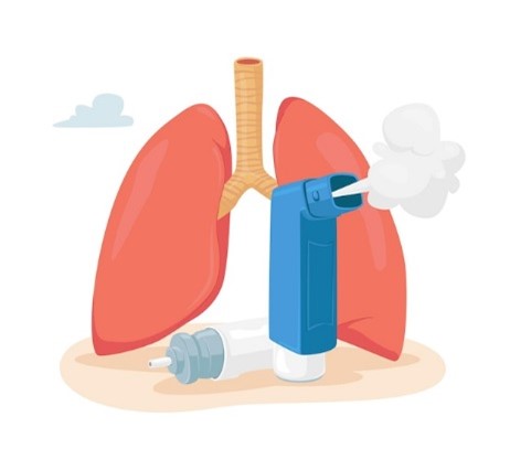 【氣管疾病專講】氣管敏感不等於哮喘？5個哮喘的迷思